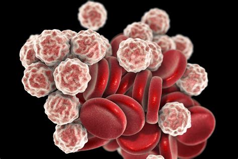 HIV and Your CBC (Complete Blood Count) .